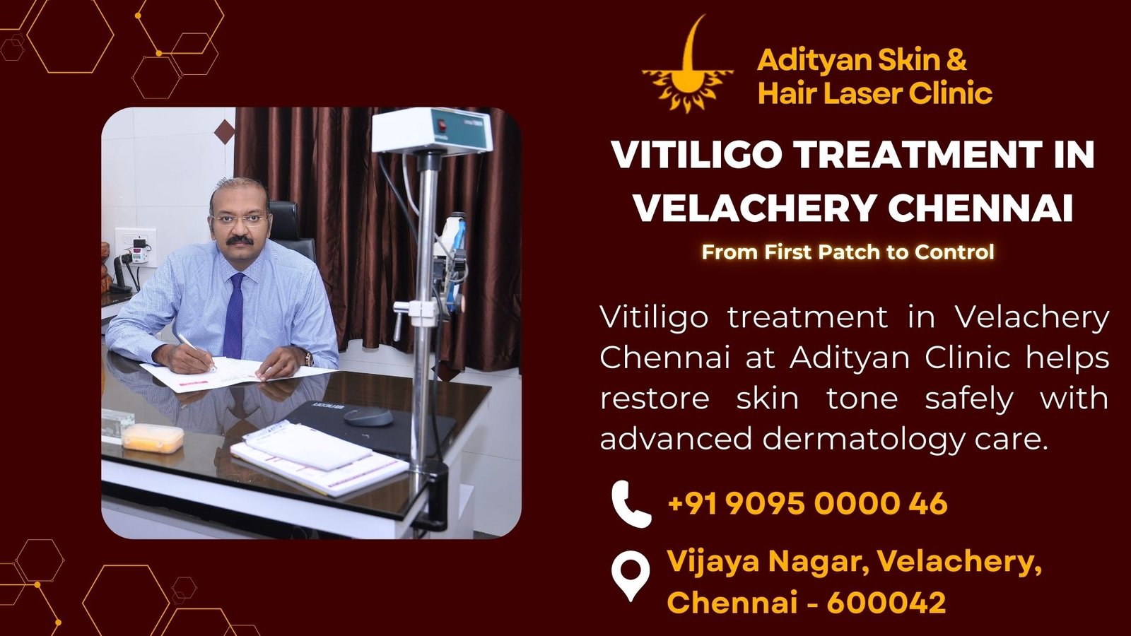 vitiligo Treatment in Velachery Chennai
