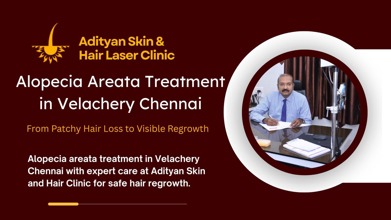 Alopecia Areata Treatment in Velachery Chennai
