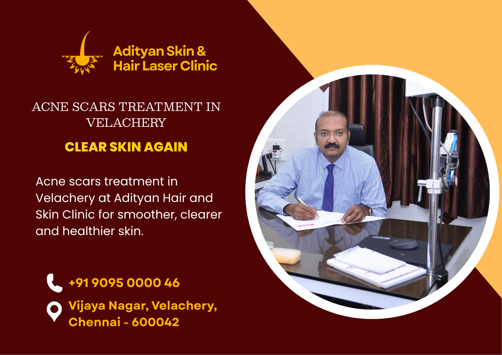 acne scars treatment in Velachery