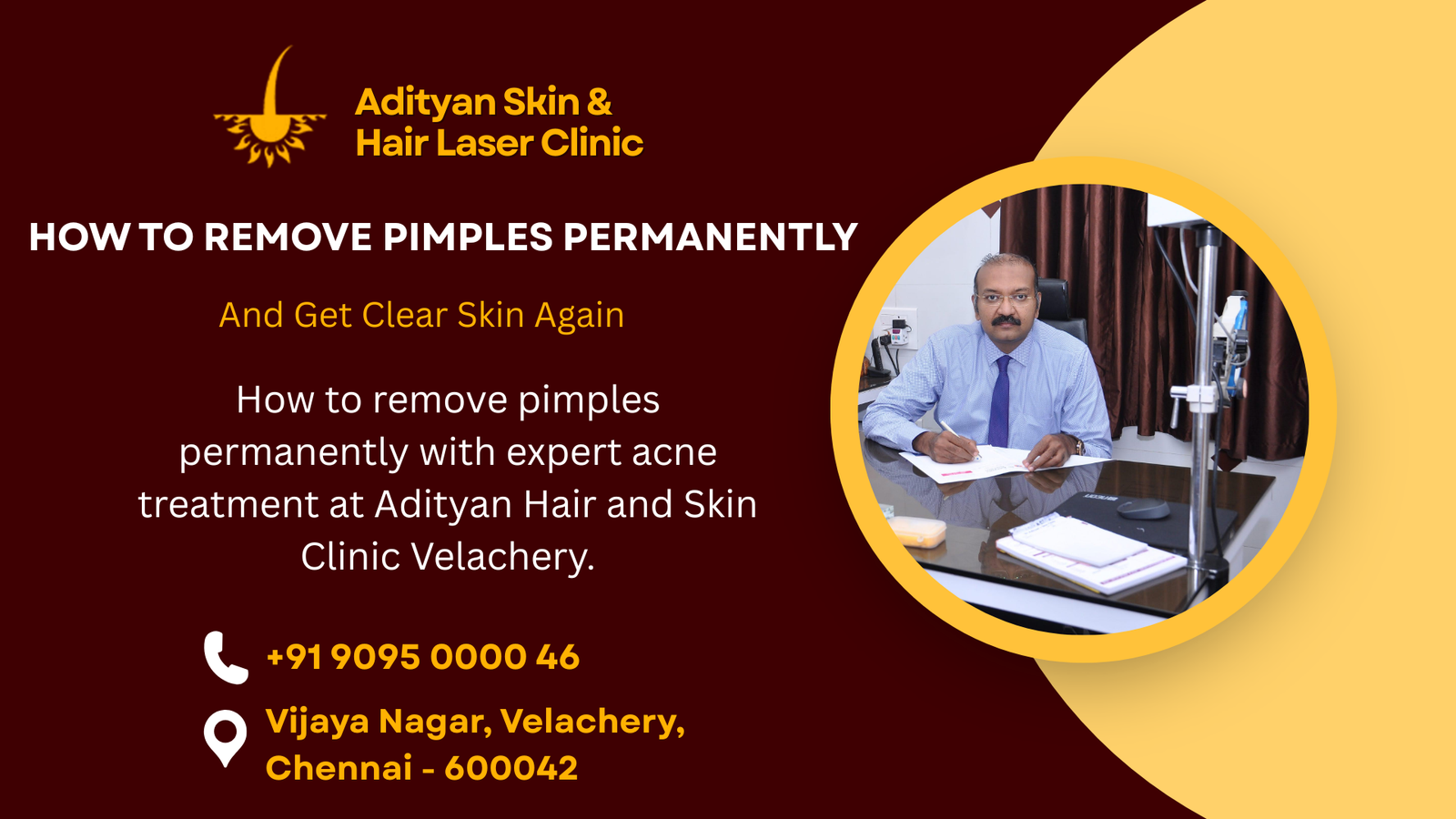 how to remove pimples permanently